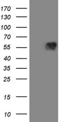 Western Blot: MAVS Antibody (OTI9C4) [NBP2-45757]