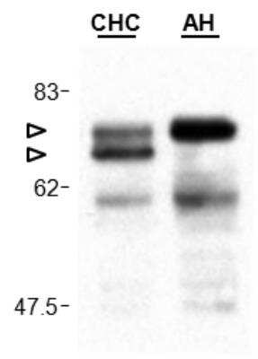 Western Blot: MAVS Antibody (Adri-1)BSA Free [NBP2-80052]