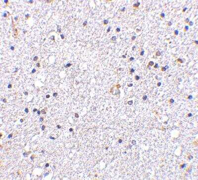 Immunohistochemistry-Paraffin: MAVS Antibody - BSA Free [NBP1-77275]