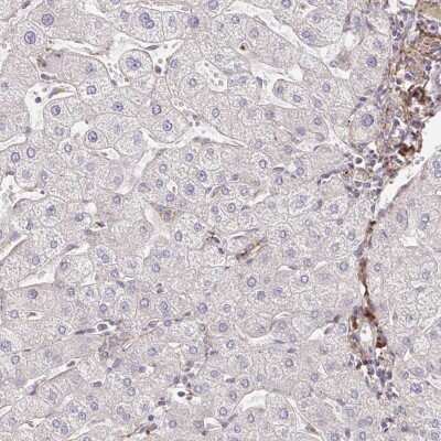 Immunohistochemistry-Paraffin: MAVS Antibody [NBP2-38613]