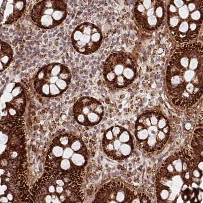 Immunohistochemistry-Paraffin: MAVS Antibody [NBP2-38613]