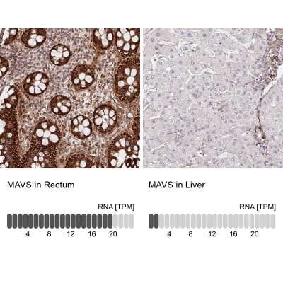 Immunohistochemistry-Paraffin: MAVS Antibody [NBP2-38613]