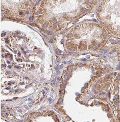 Immunohistochemistry-Paraffin: MAVS Antibody [NBP2-38613]