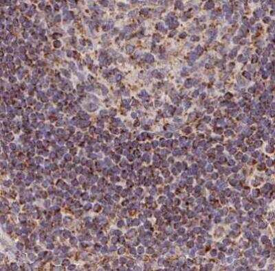 Immunohistochemistry-Paraffin: MAVS Antibody [NBP2-38613]