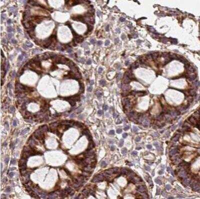 Immunohistochemistry-Paraffin: MAVS Antibody [NBP2-38613]