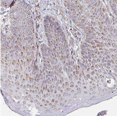 Immunohistochemistry-Paraffin: MAVS Antibody [NBP2-38704]