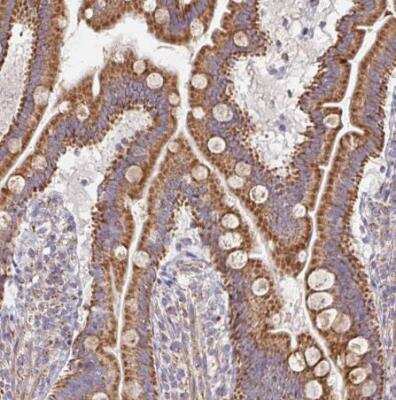 Immunohistochemistry-Paraffin: MAVS Antibody [NBP2-38704]