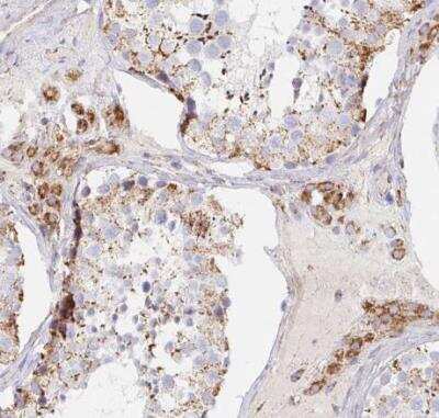 Immunohistochemistry-Paraffin: MAVS Antibody [NBP2-38704]