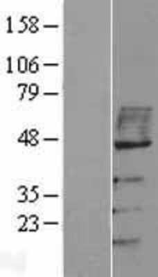 Western Blot: MAVS Overexpression Lysate [NBP2-06621]