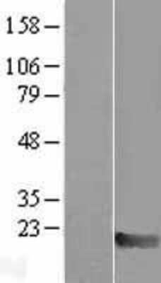 Western Blot: Max Overexpression Lysate [NBL1-12919]