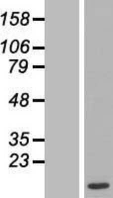 Western Blot: Max Overexpression Lysate [NBL1-12920]