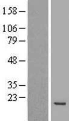 Western Blot: Max Overexpression Lysate [NBL1-12921]