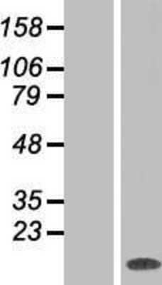 Western Blot: Max Overexpression Lysate [NBP2-05496]