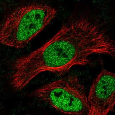 Immunocytochemistry/ Immunofluorescence: MAX binding protein Antibody [NBP2-56563]