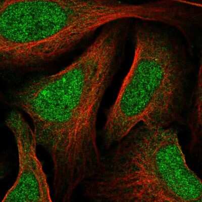 Immunocytochemistry/ Immunofluorescence: MAX binding protein Antibody [NBP2-57009]