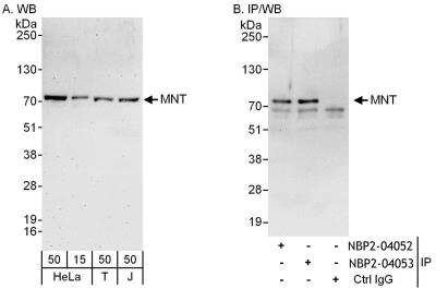 Immunoprecipitation: MAX binding protein Antibody [NBP2-04052]