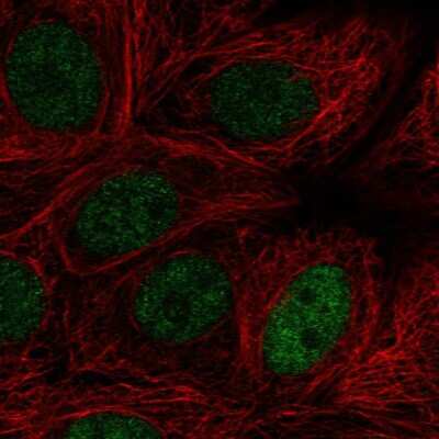 Immunocytochemistry/ Immunofluorescence: MAZ Antibody [NBP2-56933]