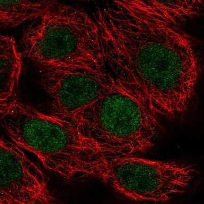 Immunocytochemistry/ Immunofluorescence: MAZ Antibody [NBP2-57338]