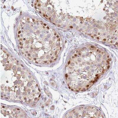 Immunohistochemistry-Paraffin: MAZ Antibody [NBP2-33519]