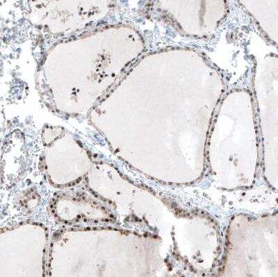 Immunohistochemistry-Paraffin: MAZ Antibody [NBP2-33519]