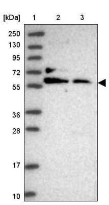 Western Blot: MAZ Antibody [NBP2-33519]