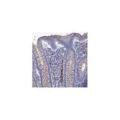 Immunohistochemistry-Paraffin: MAdCAM-1 Antibody [NBP3-18862]