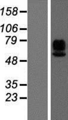 Western Blot: MAdCAM-1 Overexpression Lysate [NBP2-05729]