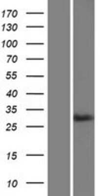 Western Blot: MAdCAM-1 Overexpression Lysate [NBP2-05730]