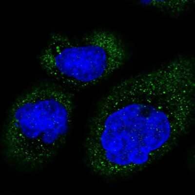 Immunocytochemistry/ Immunofluorescence: MB21D2 Antibody [NBP1-92101]