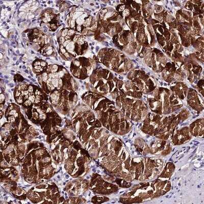Immunohistochemistry-Paraffin: MB21D2 Antibody [NBP1-92101]
