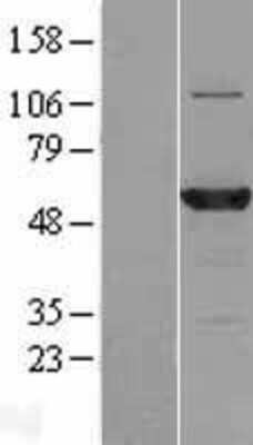 Western Blot: MB21D2 Overexpression Lysate [NBL1-08453]