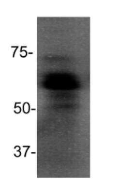 Western Blot: MBD1 Antibody (100B272.1)Azide and BSA Free [NBP2-33221]