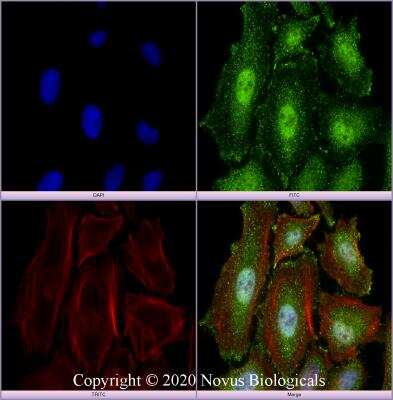 Immunocytochemistry/ Immunofluorescence: MBD1 Antibody (100B272.1) [NB100-56537]