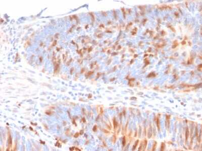 Immunohistochemistry-Paraffin: MBD1 Antibody (CPTC-MBD1-1) - Azide and BSA Free [NBP3-08387]