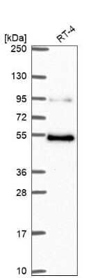 Western Blot: MBD1 Antibody [NBP2-68876]