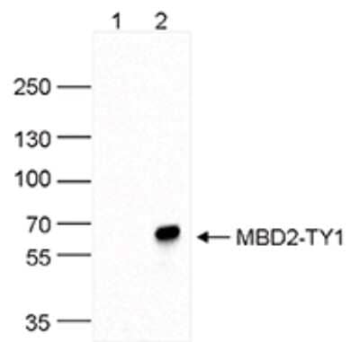 Western Blot: MBD2 Antibody [NBP3-18692]