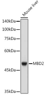 Western Blot: MBD2 Antibody (4D4D5) [NBP3-16317]