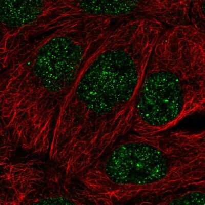 Immunocytochemistry/ Immunofluorescence: MBD2 Antibody [NBP2-56565]