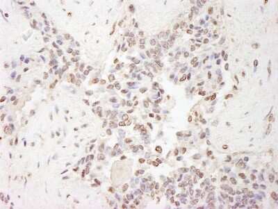 Immunohistochemistry-Paraffin: MBD2 Antibody [NB100-81657]