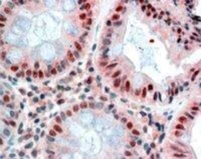 Immunohistochemistry-Paraffin: MBD2 Antibody [NB100-55415]