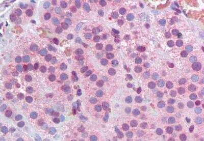 Immunohistochemistry-Paraffin: MBD2 Antibody [NB100-55415]