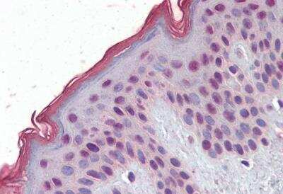 Immunohistochemistry-Paraffin: MBD2 Antibody [NB100-55415]