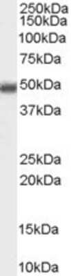 Western Blot: MBD2 Antibody [NB100-55415]