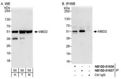 Western Blot: MBD2 Antibody [NB100-81657]