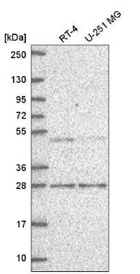 Western Blot: MBD2 Antibody [NBP2-56565]