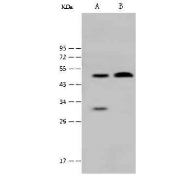 Western Blot: MBD2 Antibody [NBP2-99402]