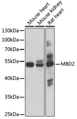 Western Blot: MBD2 AntibodyBSA Free [NBP3-04835]