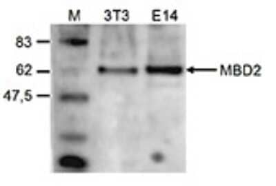 Western Blot: MBD2 Antibody [NBP3-18666]