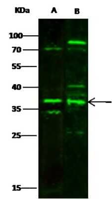 Western Blot: MBD3 Antibody [NBP3-00136]