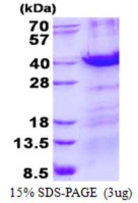 SDS-PAGE: Recombinant Human MBD3 His Protein [NBP2-23231]